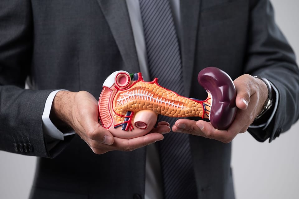 Modelo anatômico do pâncreas nas mãos do médico
