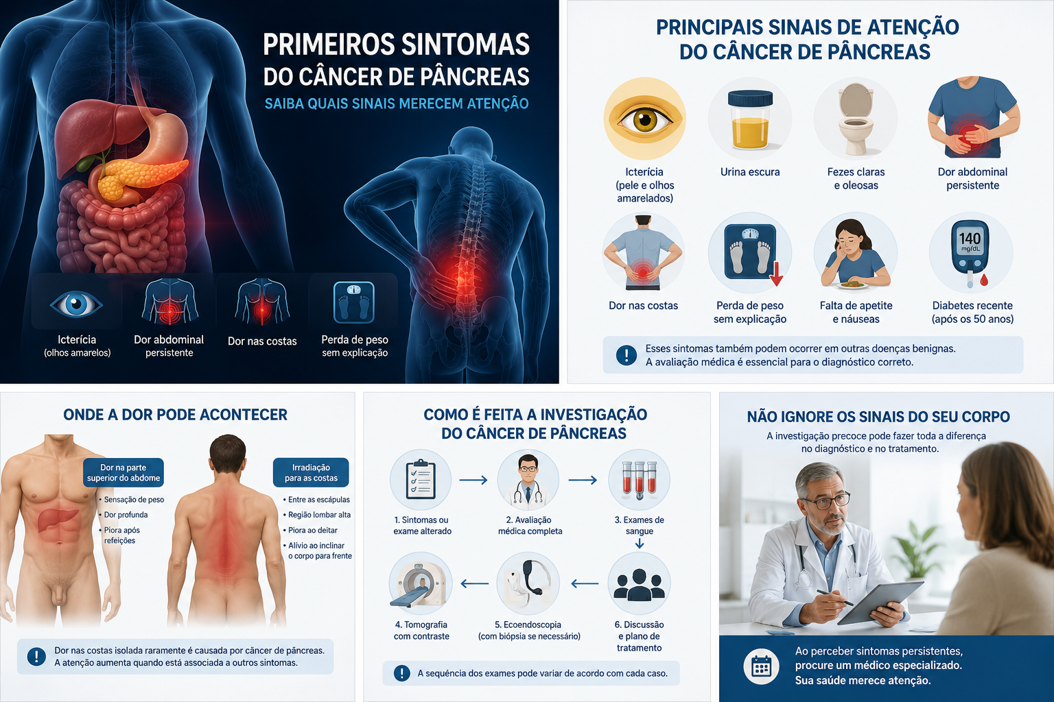 Primeiros sintomas do câncer de pâncreas, incluindo icterícia, dor abdominal, dor nas costas, perda de peso e alterações digestivas